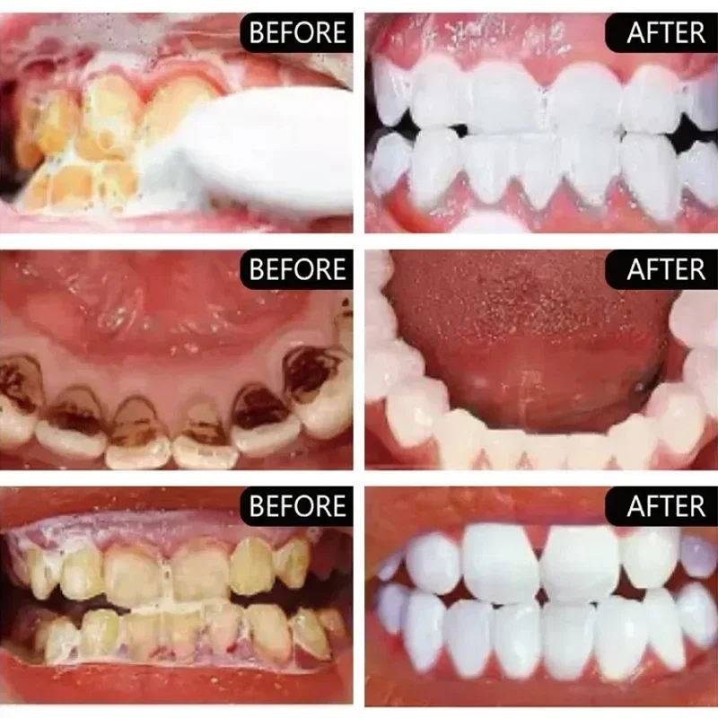 Dentifrice pour enlever les ta - Teeth Whitening Fast avis et prix
