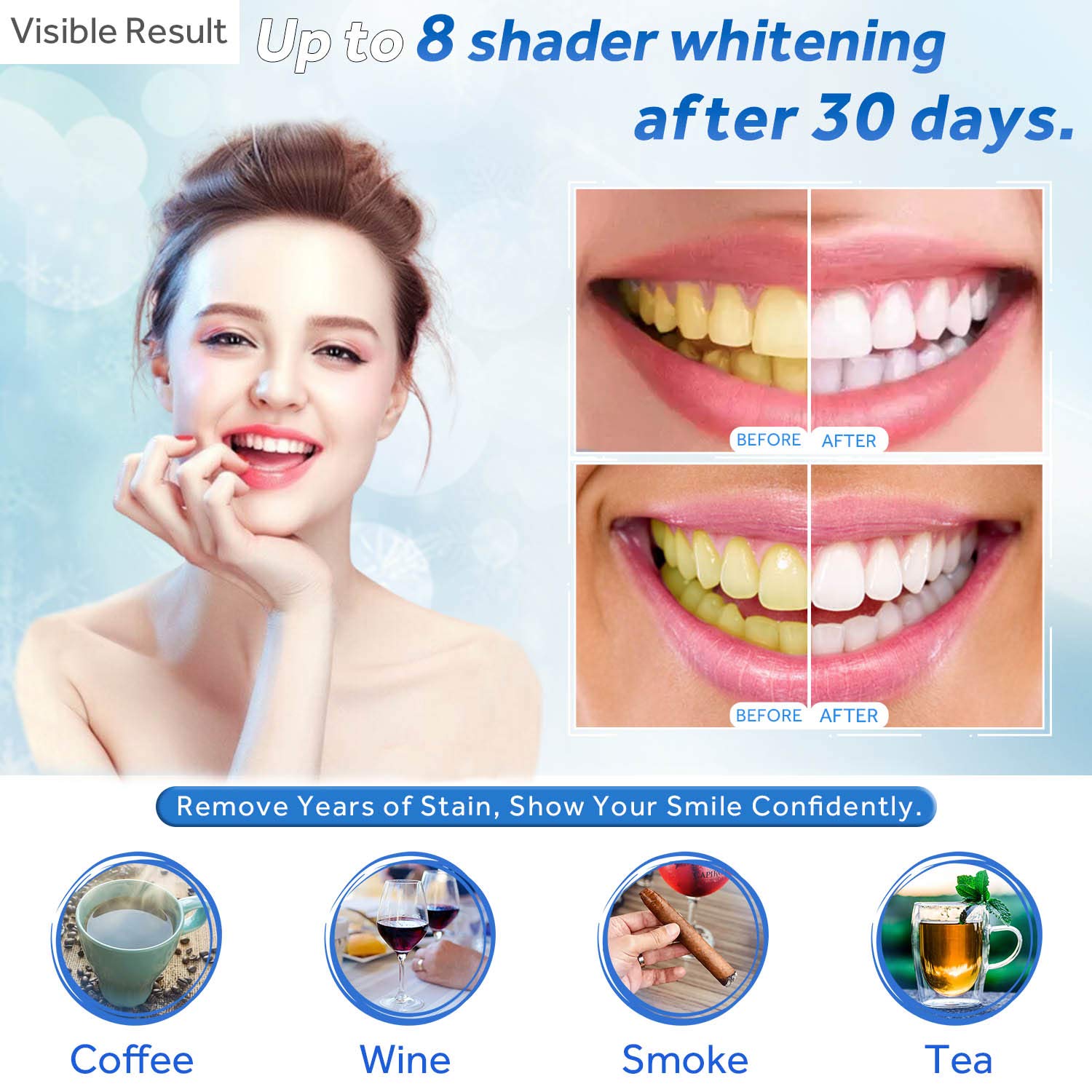 Gel de blanchiment des dents r - Teeth Whitening From Home avis et prix