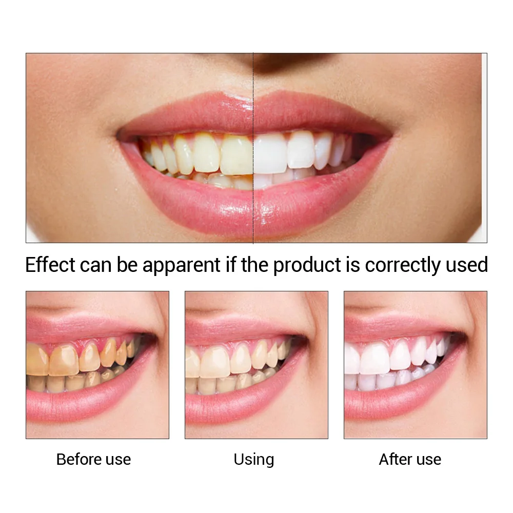 FTEENPLY poudre d'essence de b - Teeth Whitening From Home avis et prix