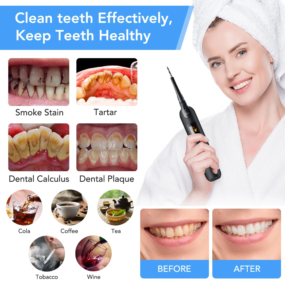 Détartreur dentaire électrique - Teeth Whitening Toothbrush avis et prix