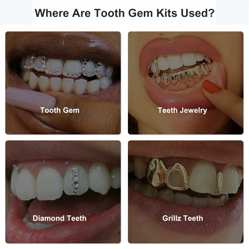 Kit de colle pour dents, ensem - Tooth Gem Kit avis et prix