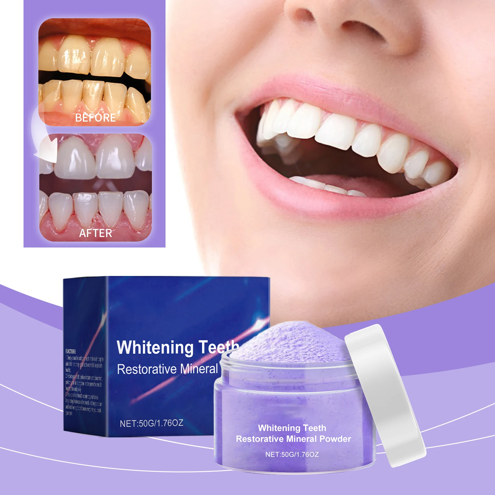 Kit de blanchiment dentaire no - Teeth Whitening Serum avis et prix