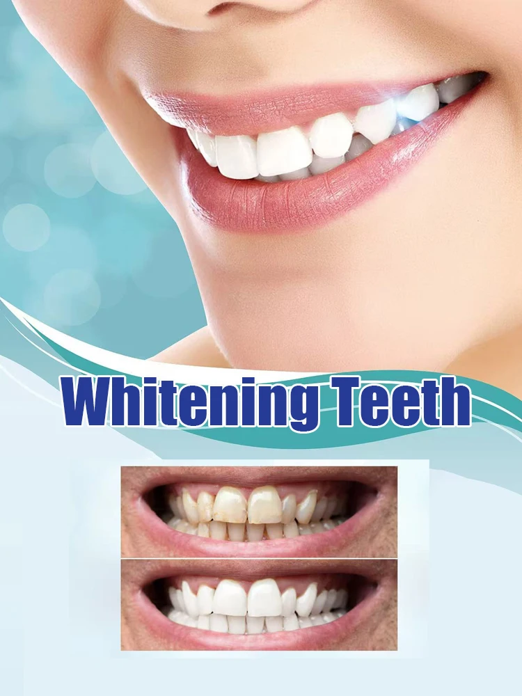 Kit de blanchiment dentaire no - Teeth Whitening Serum avis et prix