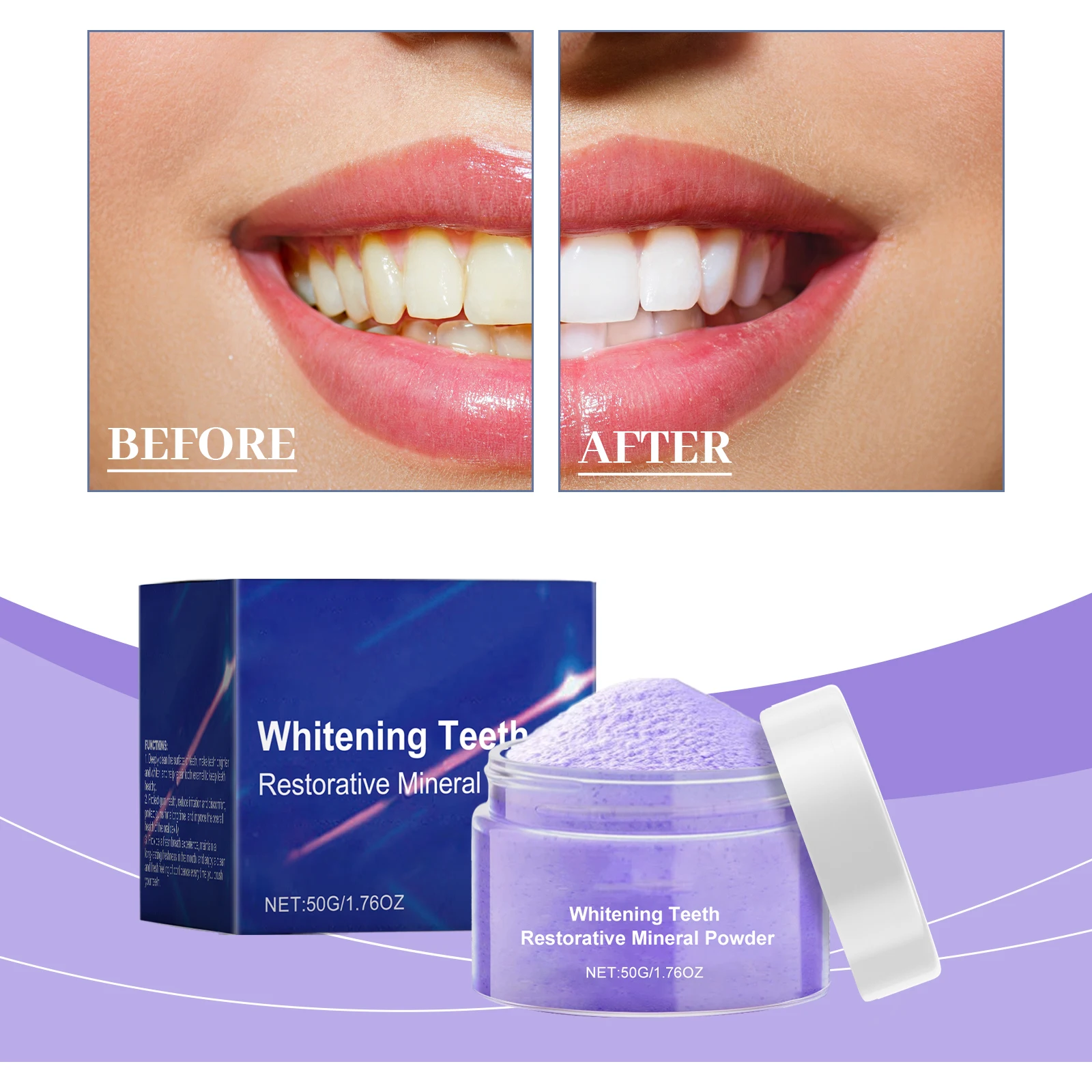 Kit de blanchiment dentaire no - Teeth Whitening Serum avis et prix