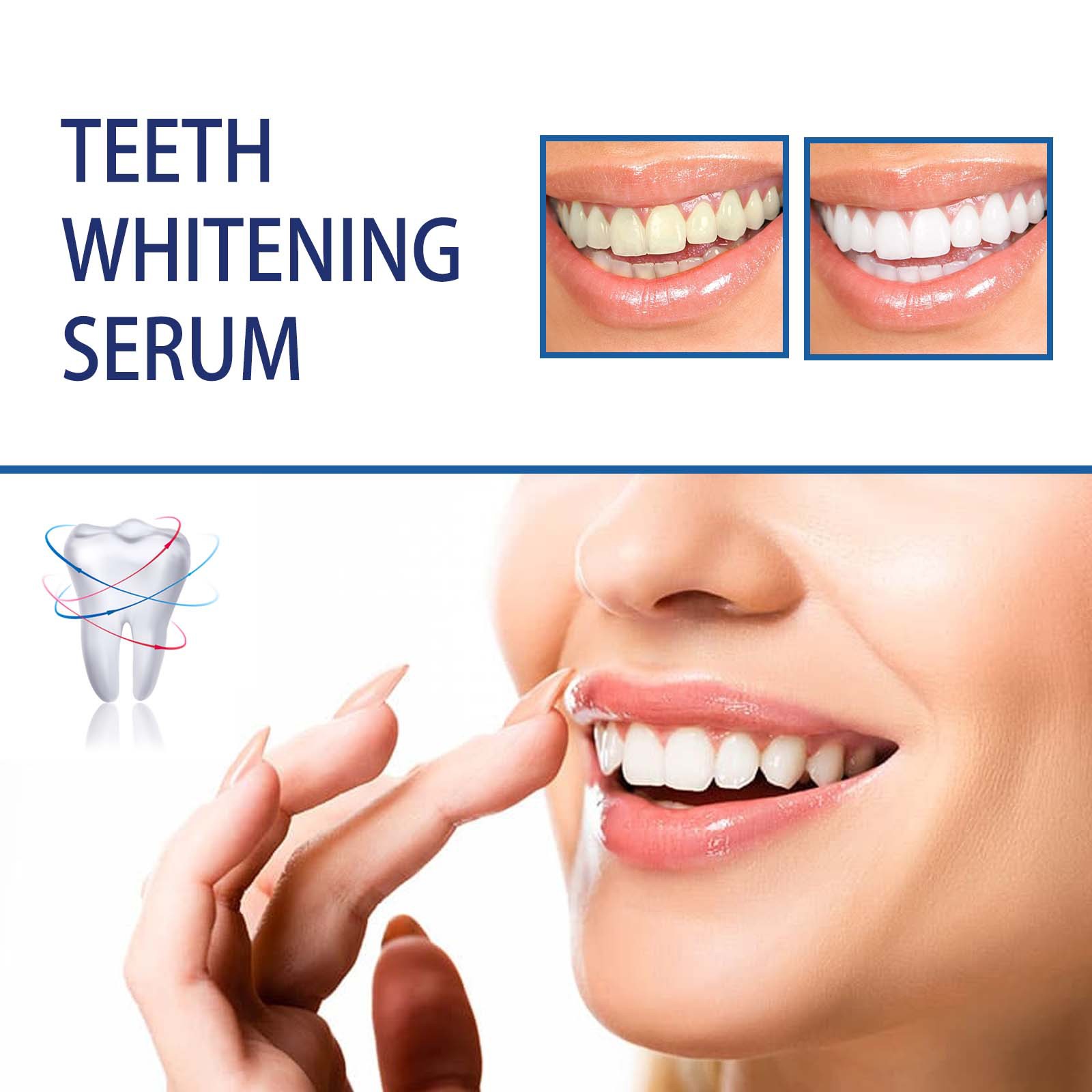 Sérum professionnel pour blanc - Teeth Whitening Serum avis et prix