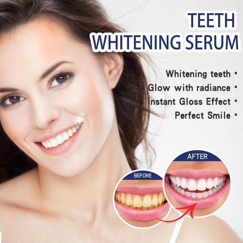Sérum professionnel pour blanc - Teeth Whitening Serum avis et prix